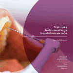Mašinska instrumentacija kanala korena zuba
