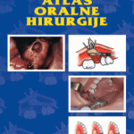 Atlas oralne hirurgije