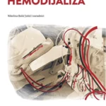 Hemodijaliza