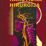Karotidna hirurgija