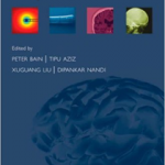 Deep Brain Stimulation