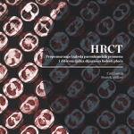 HRCT – prepoznavanje izgleda parenhimskih promena i diferencijalna dijagnoza bolesti pluća