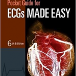 Pocket Guide for ECGs Made Easy, 6th Edition