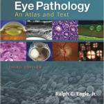Eye Pathology: An Atlas and Text, 3 Ed
