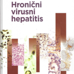 Z36151 Hronični virusni hepatitis