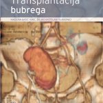 Transplantacija bubrega