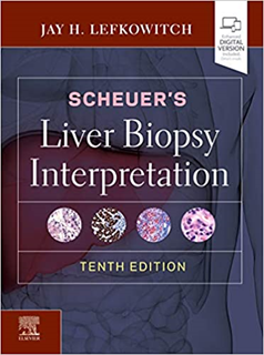 upload202112171858194639.png Scheuers Liver Biopsy Interpretation - Slika 1