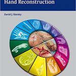 The Art of Microsurgical Hand Reconstruction