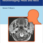 Differential Diagnosis in Neuroimaging