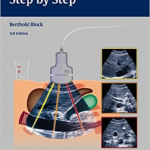 Abdominal Ultrasound: Step by Step