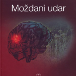Moždani udar