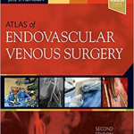 Atlas of Endovascular Venous Surgery
