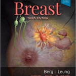 Diagnostic Imaging: Breast