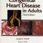 Congenital Heart Disease in Adults,