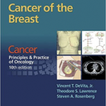 Cancer Of The Breast                  Pb