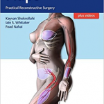 Flaps -Practical Reconstructive Surgery
