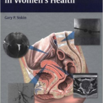 Interventional Radiology in Women's Health