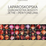 Z36165 Laparoskopska dijagnostika bolesti jetre i peritoneuma