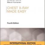 Chest X-Ray Made Easy, International Edition, 4th Edition
