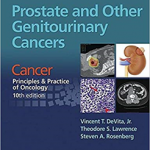 PROSTATE OTHER GENITOURINARY CANCER   PB