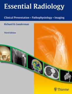Essential Radiology. Clinical Presentation - Pathophysiology - Imaging