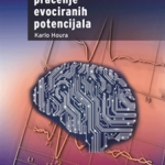 Intraoperativno praćenje evociranih potencijala