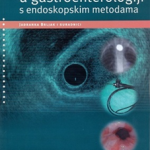 Zdravstvena Njega U Gastroenterologiji S Endoskopskim Metodama