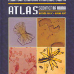 Klinički značaj analize urina : atlas sedimenta urina