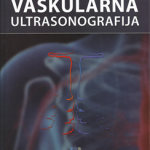 Vaskularna ultrasonografija