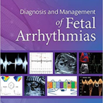 Diagnosis Management Fetal Arrhythmia Cb