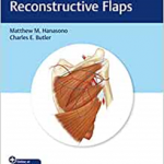 Handbook of Reconstructive Flaps
