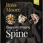 Diagnostic Imaging Spine