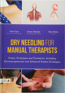 upload202112171946081084.png Dry Needling for Manual Therapists - Slika 1