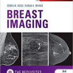 Breast Imaging: The Requisites
