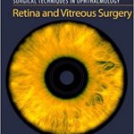 Surgical Techniques in Ophthalmology: Retina and Vitreous Surgery