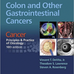 Colon Other Gastrointestinal Cancer   Pb