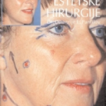 Tajna estetske hirurgije