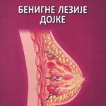 Benigne lezije dojke
