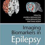 Imaging Biomarkers In Epilepsy