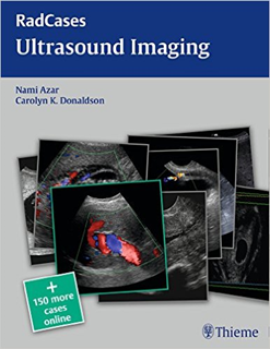Ultrasound Imaging
