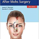 Facial Reconstruction After Mohs Surgery
