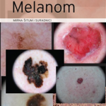 MELANOM, udžbenik i atlas