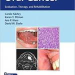Oral Cancer: Evaluation, Therapy, and Rehabilitation