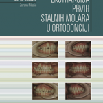 Ekstrakcija prvih stalnih molara u ortodonciji