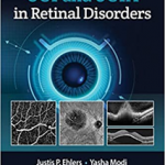 Oct Oct Angiography Retinal Disorders Pb