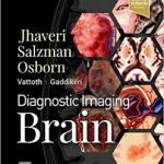 Diagnostic Imaging Brain