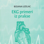 EKG primeri iz prakse