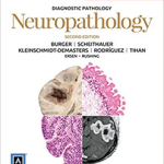 Diagnostic Pathology: Neuropathology, 2nd Edition