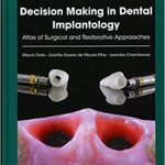 Decision Making In Dental Implantology