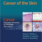 Cancer of the Skin: From Cancer: Principles & Practice of Oncology, 10th Ed